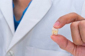 Dentist holding extracted tooth between thumb and forefinger