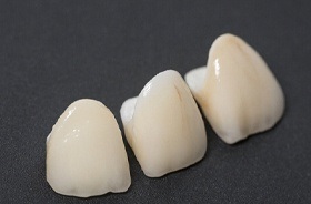 dental crowns