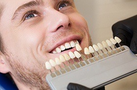 Man's smile compared with tooth color chart