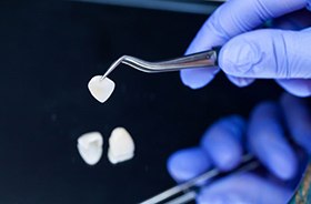 Gloved hand using forceps to hold dental crown