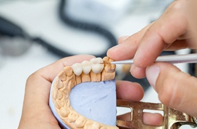 close-up of dental technician working on porcelain bridge