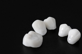 assortment of white porcelain restorations on dark background