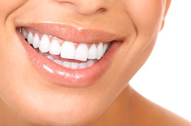 Close-up of woman’s bright smile with healthy teeth