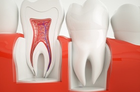 graphic of teeth