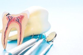 root canal treatment concept