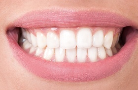 Close-up of smile with tooth-colored fillings in Lebanon NH