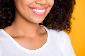 Close-up of woman’s radiant smile after getting veneers in Lebanon