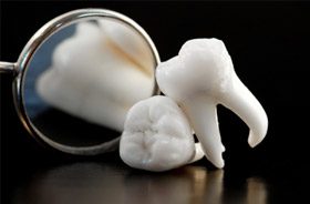 extracted teeth